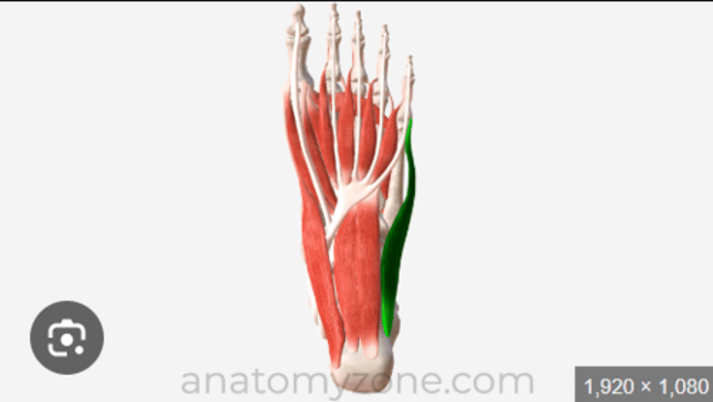 <p>what is the muscle highlighted in green?</p>
