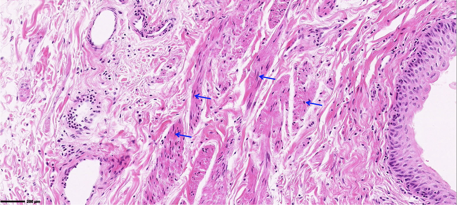 <ol><li><p>Classify the epithelium</p></li><li><p>ID the predominant connective tissue</p></li><li><p>ID the cells at the arrows</p></li></ol>