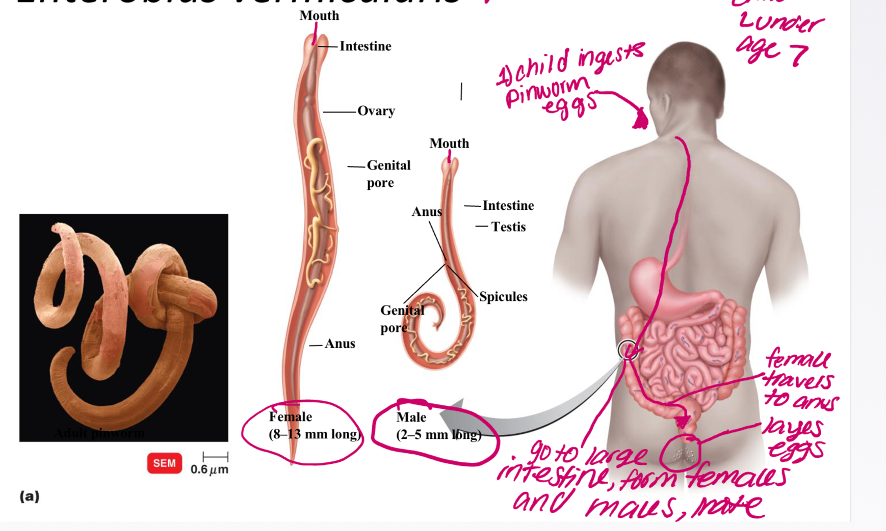 Round worms, Dioecious

* Ex: Enterobius vermicularis= pinworm, usually infects children, lays eggs on anus
* Ex: Necator americanus= Hookworm, burrow through skin, enter circulatory and respiratory system, poor sanitation