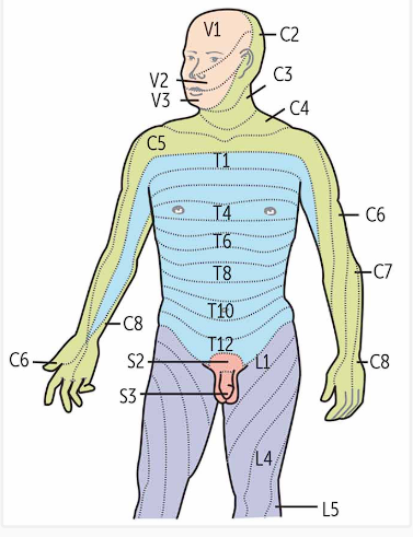 <p>Lesions follow a <strong>dermatomal distribution </strong>which is based on a skin map that has various layers supplied by a <strong>unique spinal nerve root</strong></p>