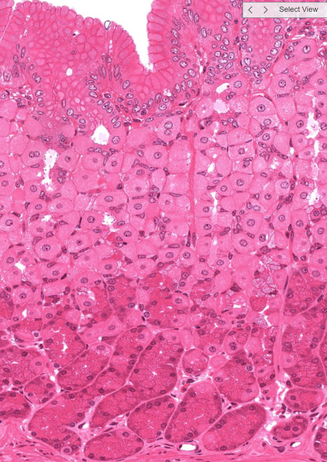 <p>top: parietal cells, fried egg appearance, then bottom: chief/ peptic cells: zymogen granules visible</p>