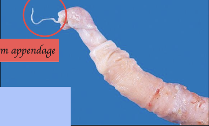 <p><span>The penis shown in this picture belongs to which species? What are the key characteristics?</span></p>