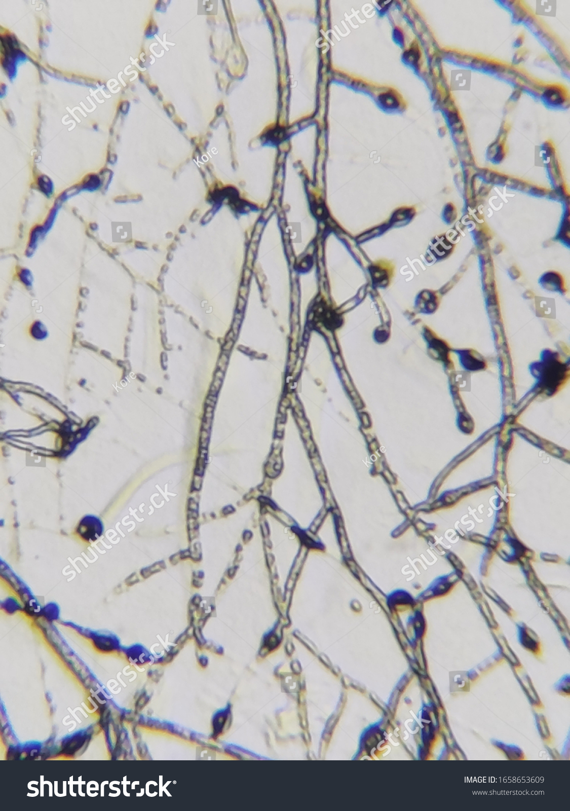 <p>what microbe is this</p>