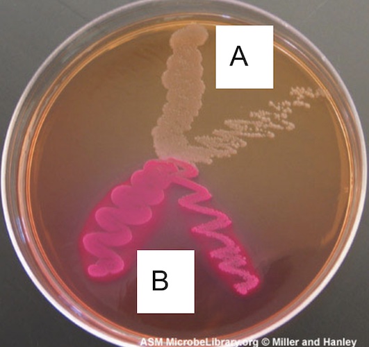 <p>which ferments lactose?</p>