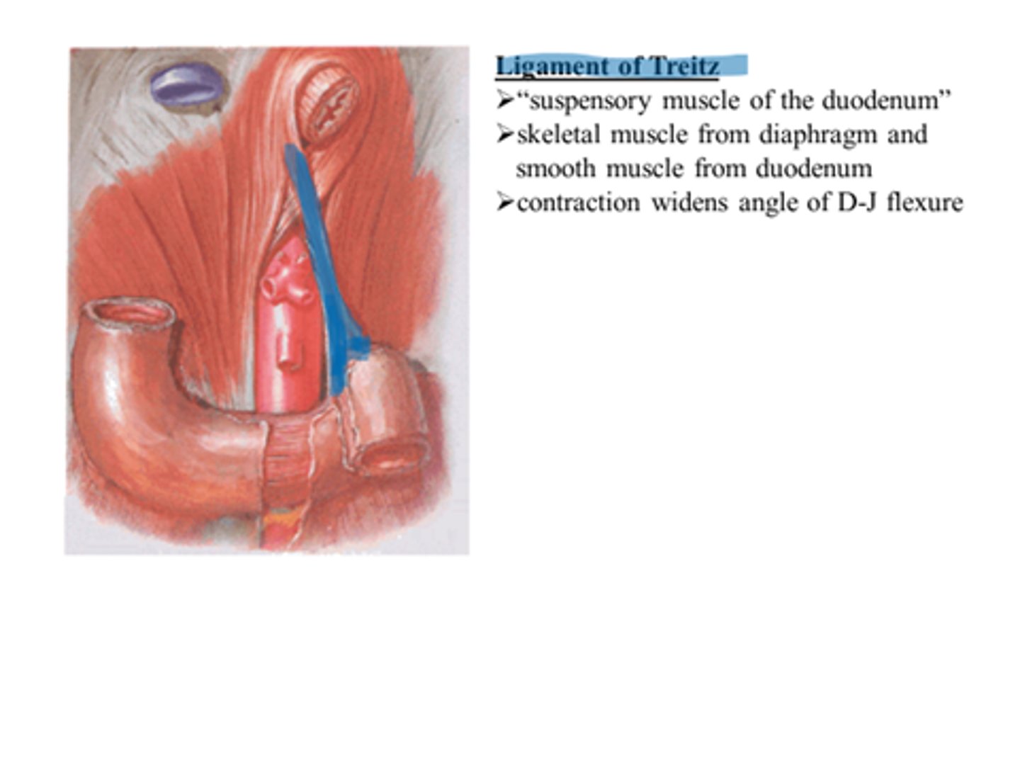 <p>above ligament of Treitz/suspensory ligament of duodenum = upper GI bleeds<br>below ligament of Treitz/suspensory ligament of duodenum = lower GI bleeds</p>