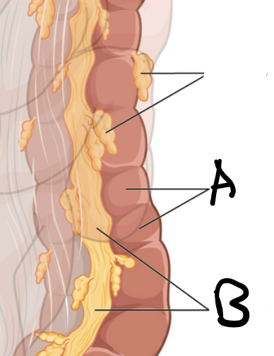 <p>A</p>