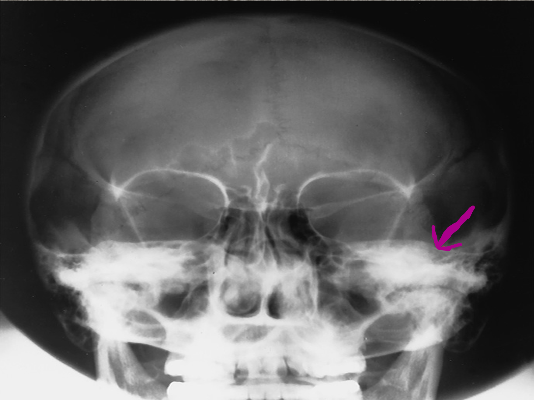 <p>What is the ARROW pointing to?</p>
