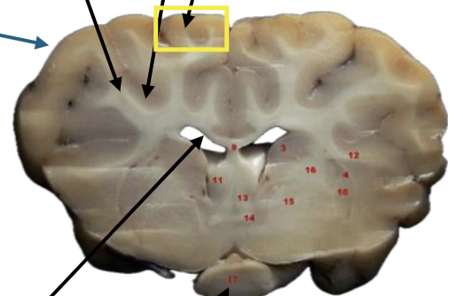 <p>What is this highlighted figure?</p>