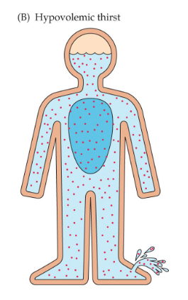 <p>Caused by a more significant decrease in the overall volume of extracellular fluid</p><p>Due to vomiting, hemorrhage, or sustained diarrhea; detected by baroreceptors</p><p>Doesn’t change concentration, just volume</p>