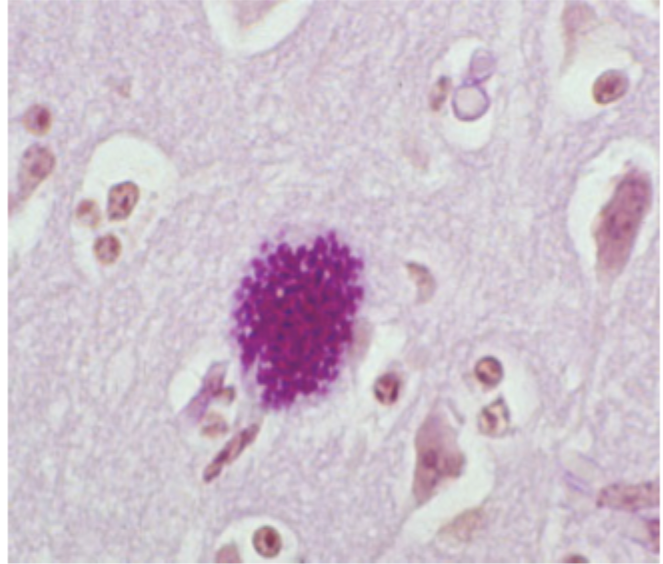 <p>What is seen in this image of an infected mouse brain?</p>