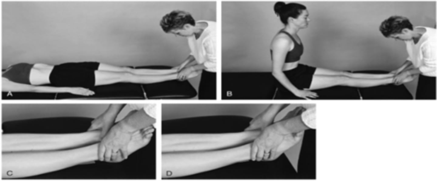 <p>therapist passively flexes both legs and then extends them</p><p>- compare positions of the malleoli in supine and then compare when patient comes into sitting</p>