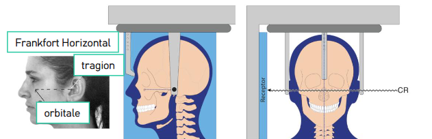 <ul><li><p>mid-sagittal plane vertical, paralleling receptor </p></li><li><p>Frankfort plane horizontal </p></li><li><p>maximum intercuspation </p></li><li><p>pt R side toward the receptor </p></li></ul><p></p>