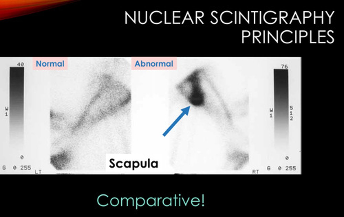 <p>When performing nuclear scintigraphy, you inject a drug that is bound to a rapidly decaying radioactive atom. What is the most common drug?</p>