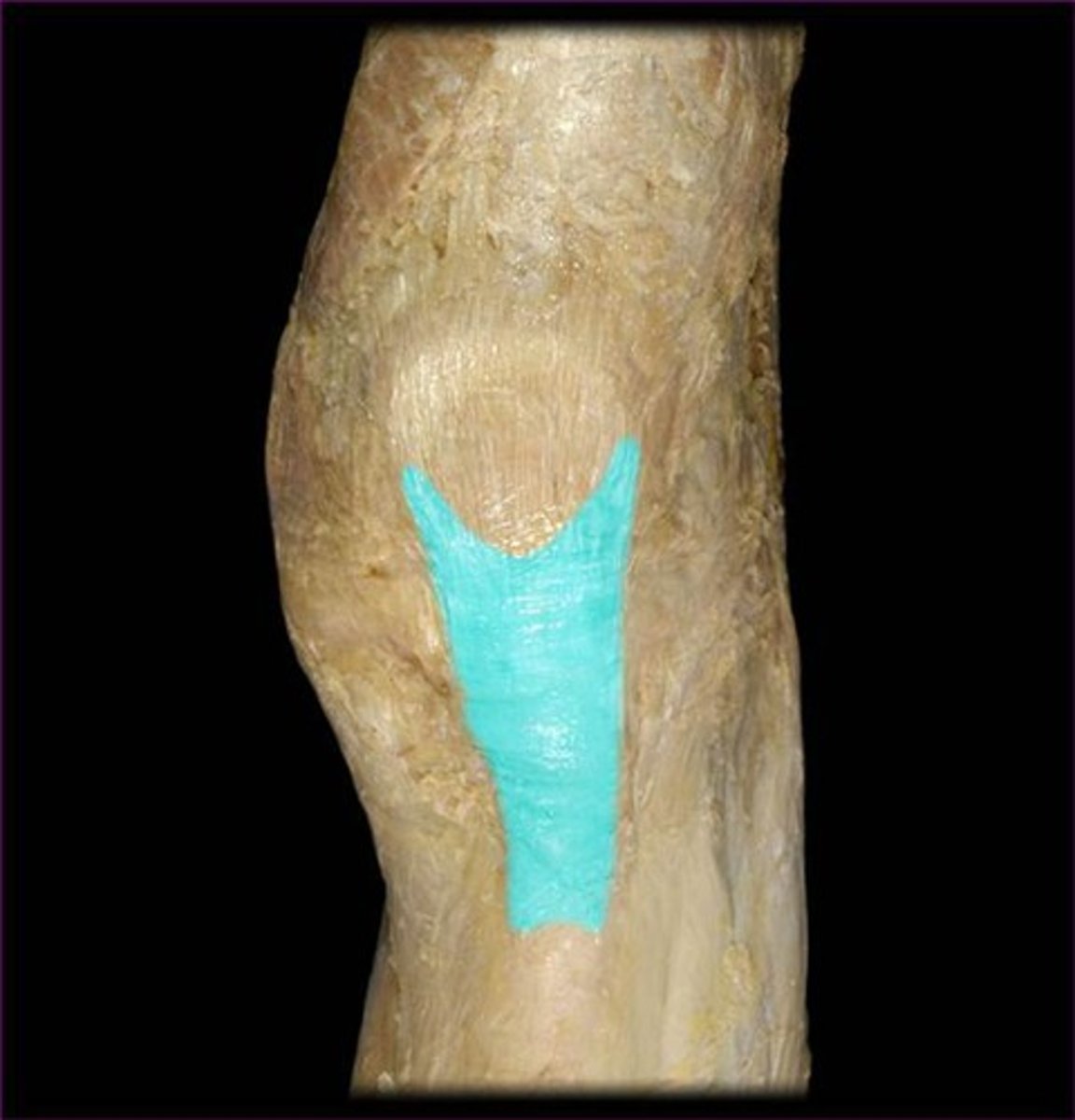 <p>Name this connective tissue structure.</p>