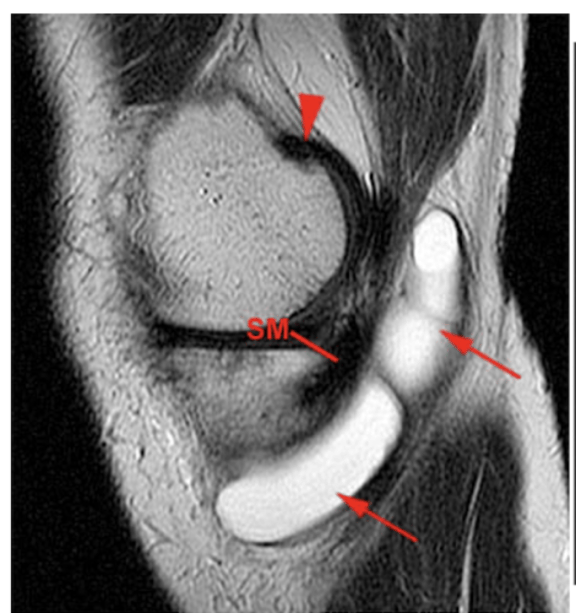 <p>Define the pathology.</p>