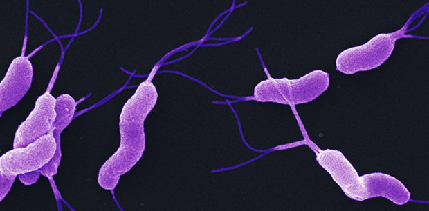 <p>What is this?</p><p>-Flagella <strong>"tuft"</strong></p><p>-Cluster at <strong>one </strong>or <strong>both ends</strong></p><p>-Associated with <strong>H. pylori</strong></p>