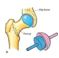 <p>Type of synovial joint. <span><span>Ball-shaped surface fits into the cuplike depression of another. Flexion/Extension, Ab/Adduction, and Rotation. Ex. Shoulder, Hip</span></span></p>