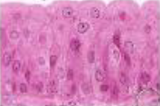 <p>Identifica el tejido</p>