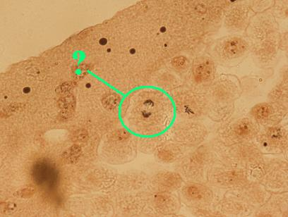 <p><span style="font-family: Lato Extended, Lato, Helvetica Neue, Helvetica, Arial, sans-serif">Identify the indicated phase of mitosis.</span></p>