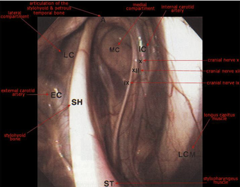 <p>what runs in the guttural pouch</p>
