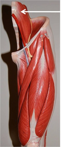 <p>What muscle is this? What is an origin? What is an insertion? What is an action?</p>