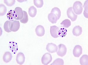 Late schizont plasmodium malariae