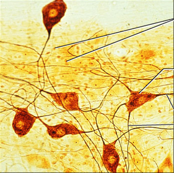 <p>what is the tissue?</p>
