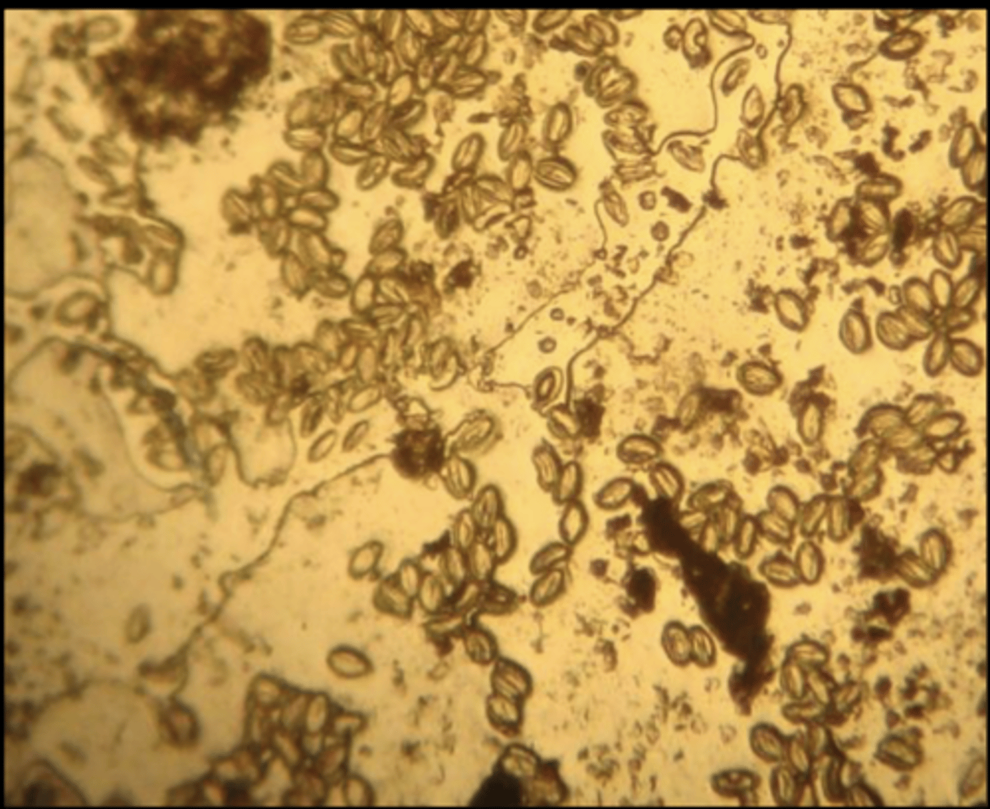 <p>What egg does this parasite belong to? From tape impression of perianal hairs</p>