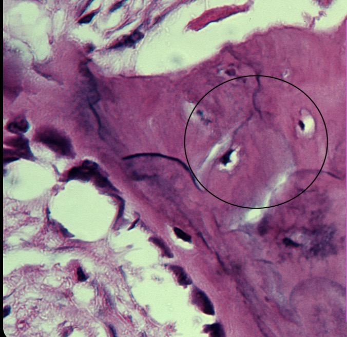 <p>Osteocito </p>