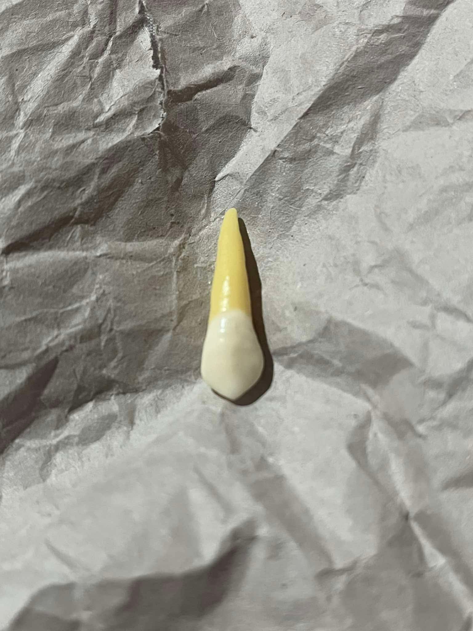 <p>What tooth is this (with view)?</p>