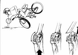 <p>clavicle fracture most common mechanism </p>