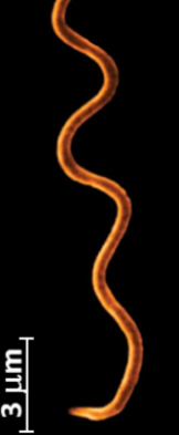 <p>What shape of bacteria is this?</p>