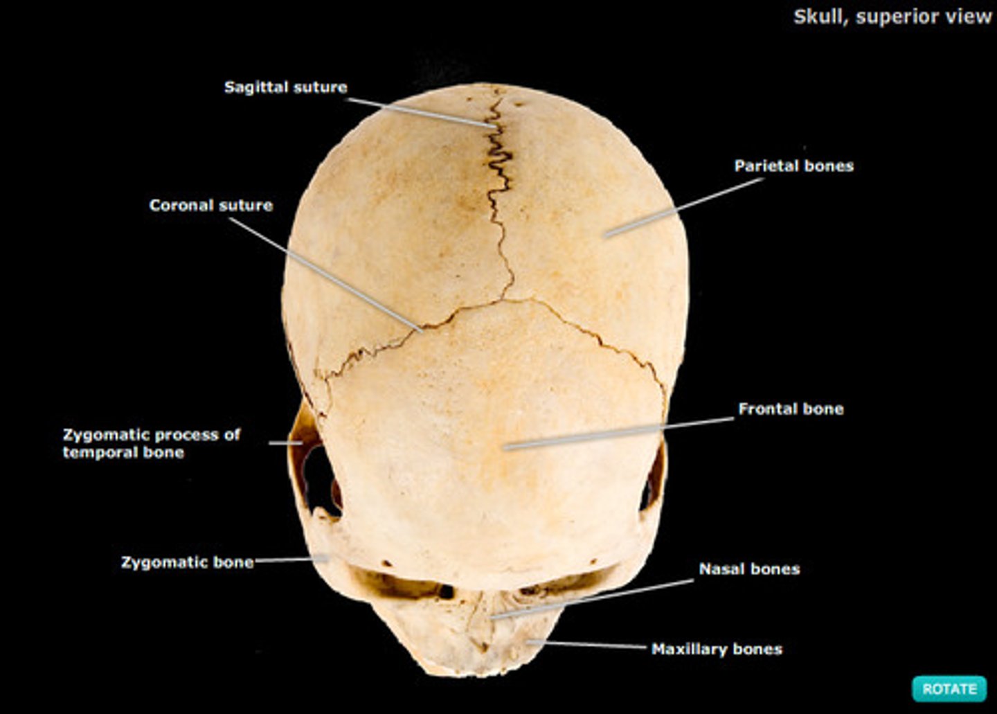 <p>a joint that does not move; the skull</p>