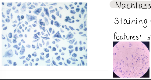<p>SDH activity</p><p>Nachlass reaction</p><p>staining : feulgen</p><p>features : blue granules near red stained nucleus</p>
