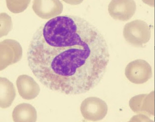 <p>large red cytoplasmic granules, found in response to allergies and worms</p>