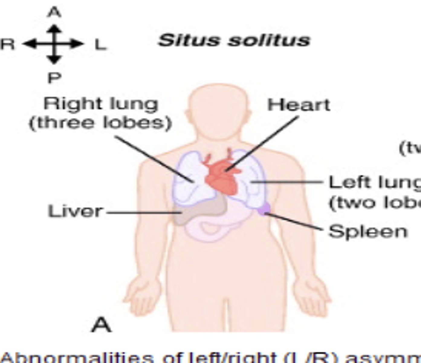 <p>normal arrangement of organs</p>