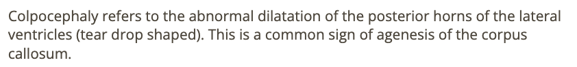 <p>c) agenesis of corpus callosum</p>