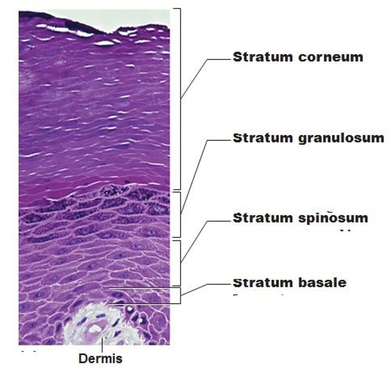 <p>Stratum corneum, stratum lucidum, stratum granulosum, stratum spinosum, stratum basale</p>