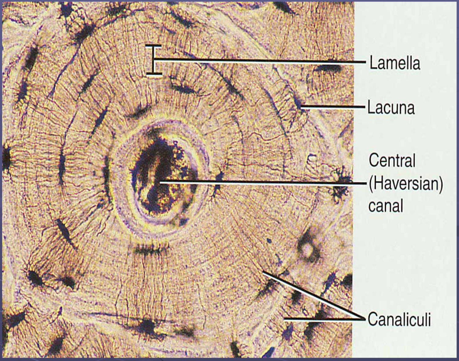 <p>Parts of compact bone (osteon, lamelle, canaliculi, lacunae, central canal, perforating canals, interstitial lamelle, etc)</p><p></p>