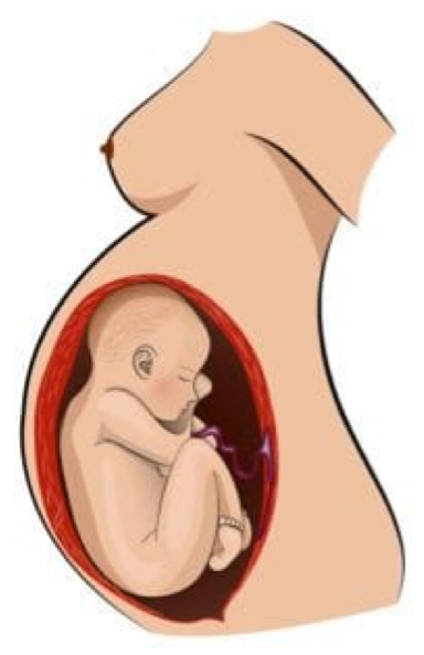 <p>Cehpalic or breech?</p>