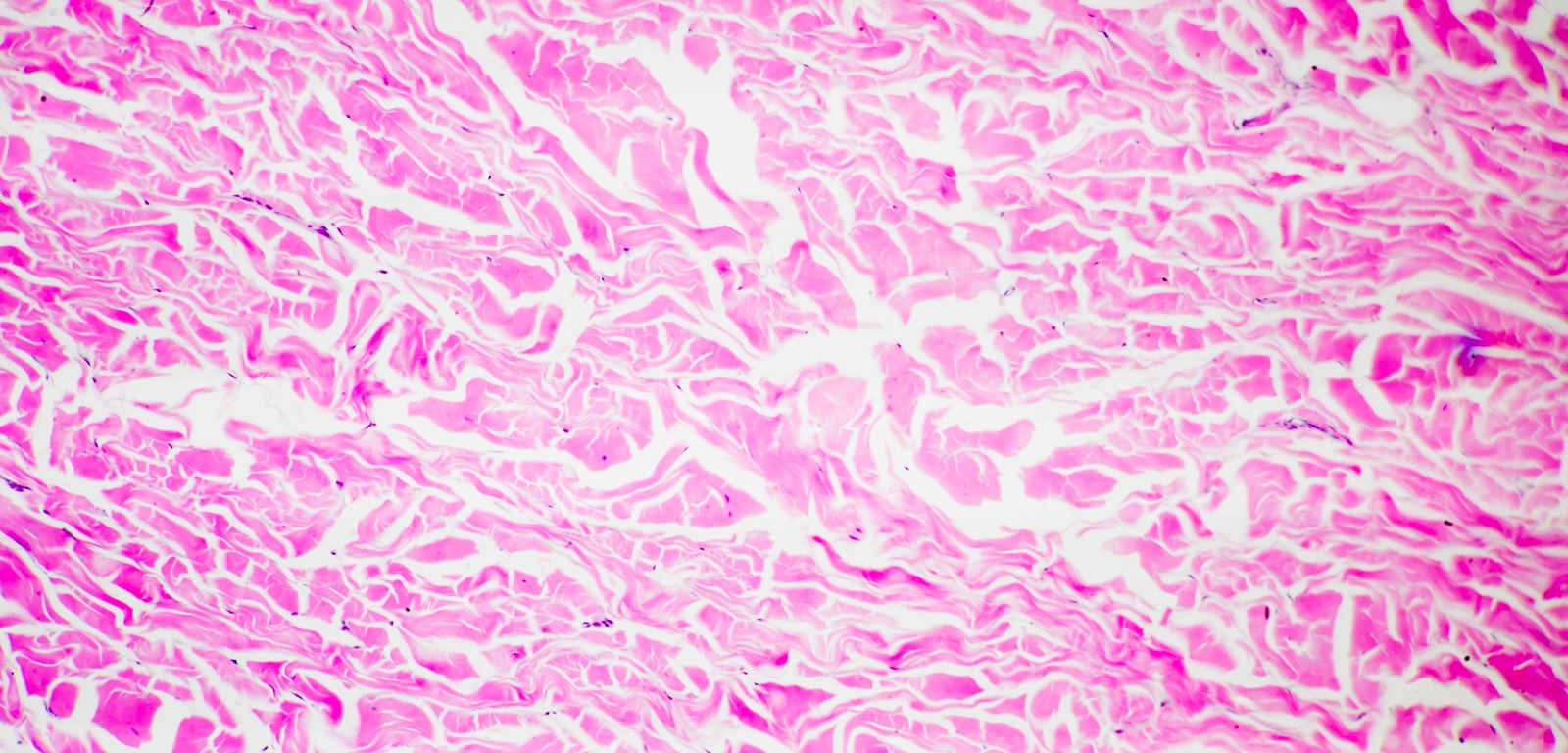 <p>Dense Irregular Tissue:</p>