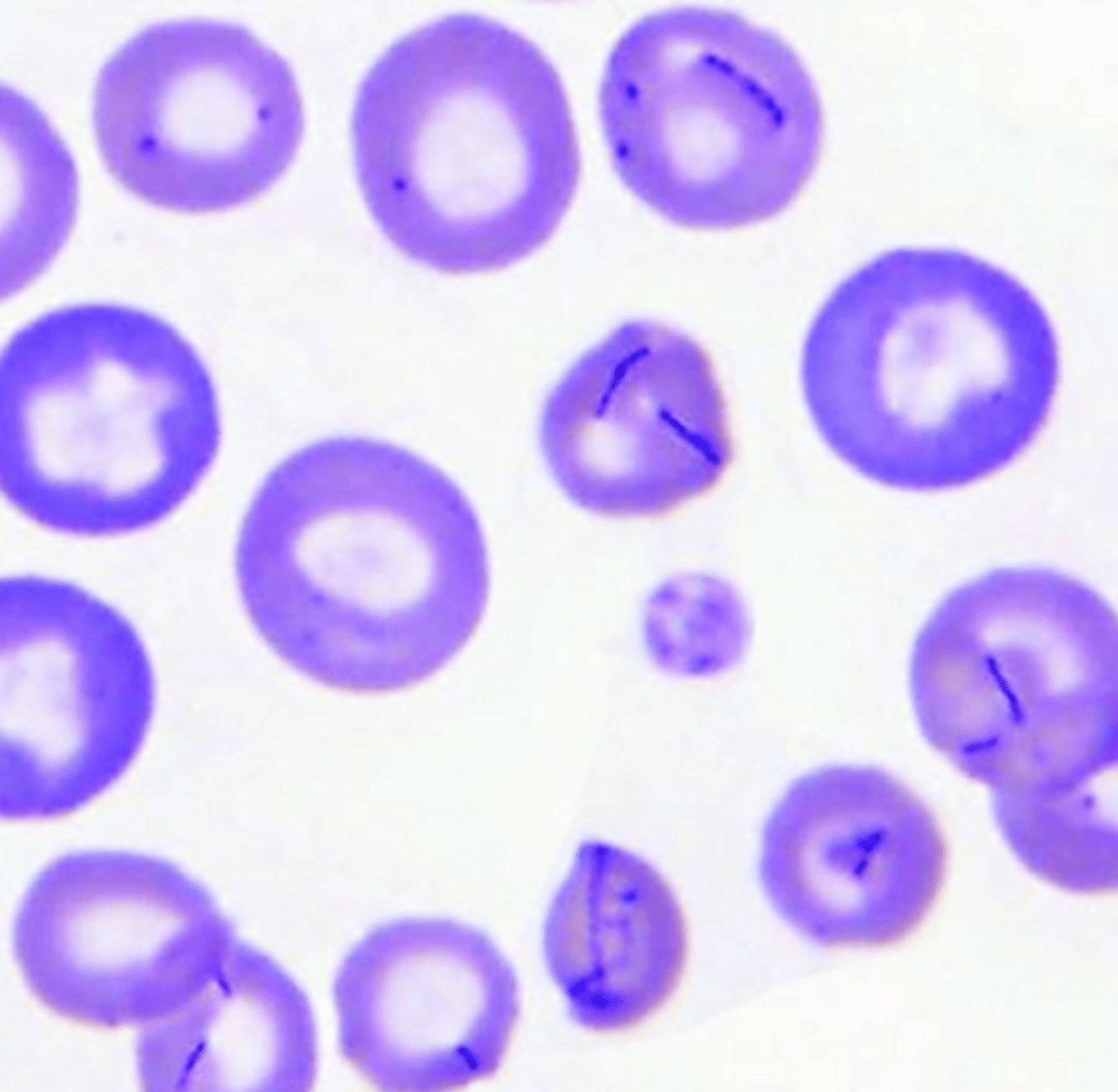 <p>Mycoplasma haemofelis will cause what? </p>