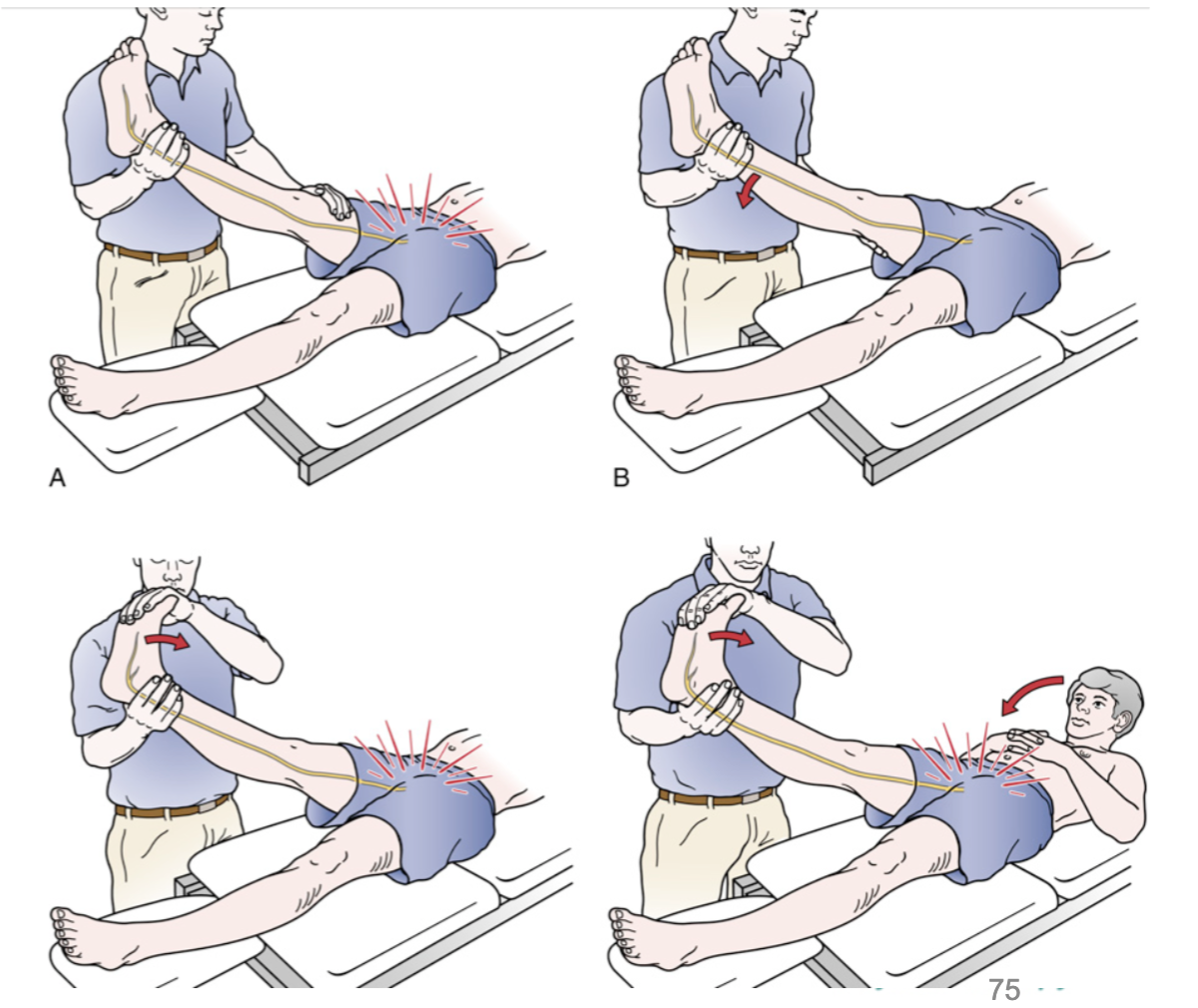 <p>Describe how to perform the straight leg raise</p>