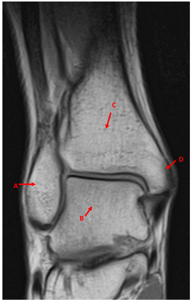 <p>C</p>