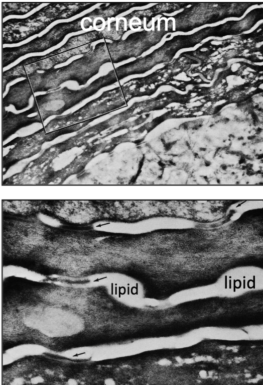<p>lipid (water proofs skin and keeps fluid in!!)</p>