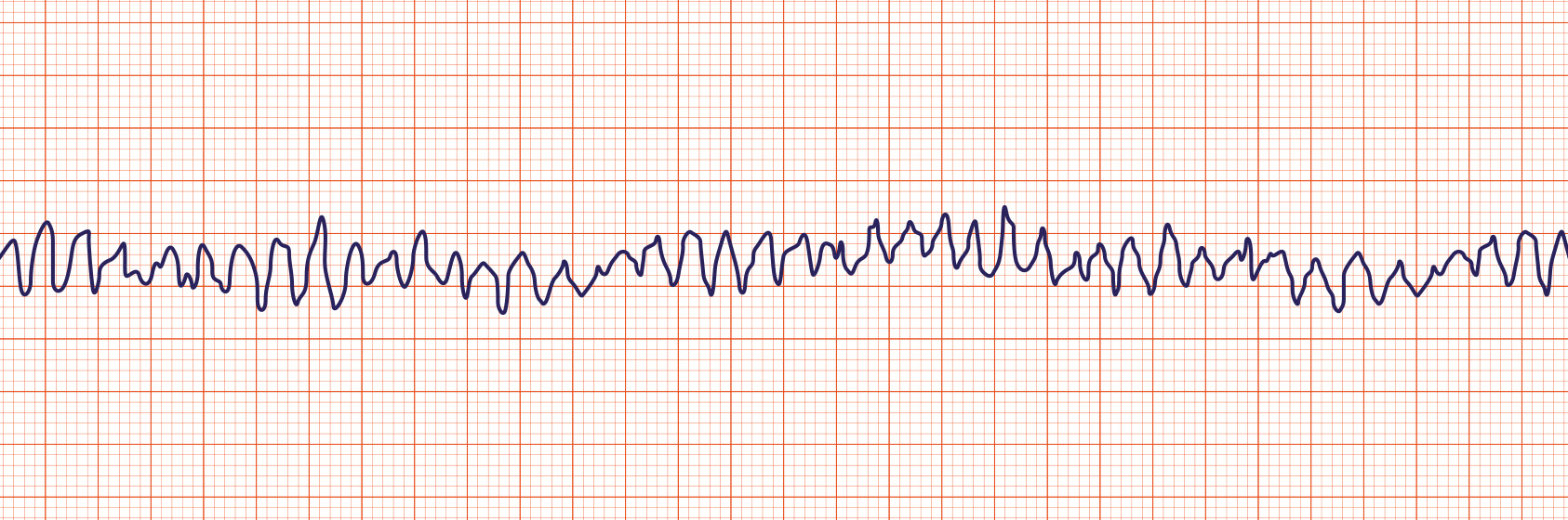<p>What Rhythm is This?</p>