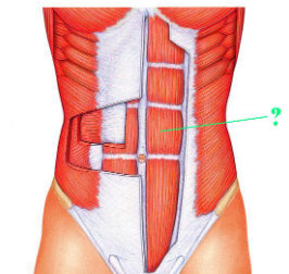 <p><span>Identify the indicated muscle.</span></p>