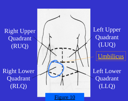 <ol start="3"><li><p>Right Lower Quad(RLQ)</p></li></ol><p></p>