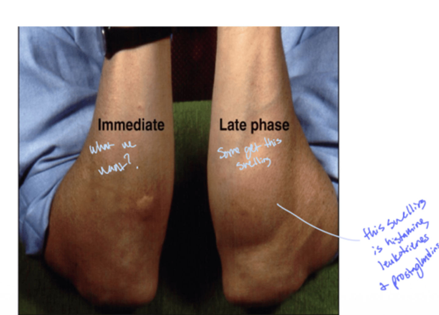 <p>A: Leukotrienes and prostaglandins</p>