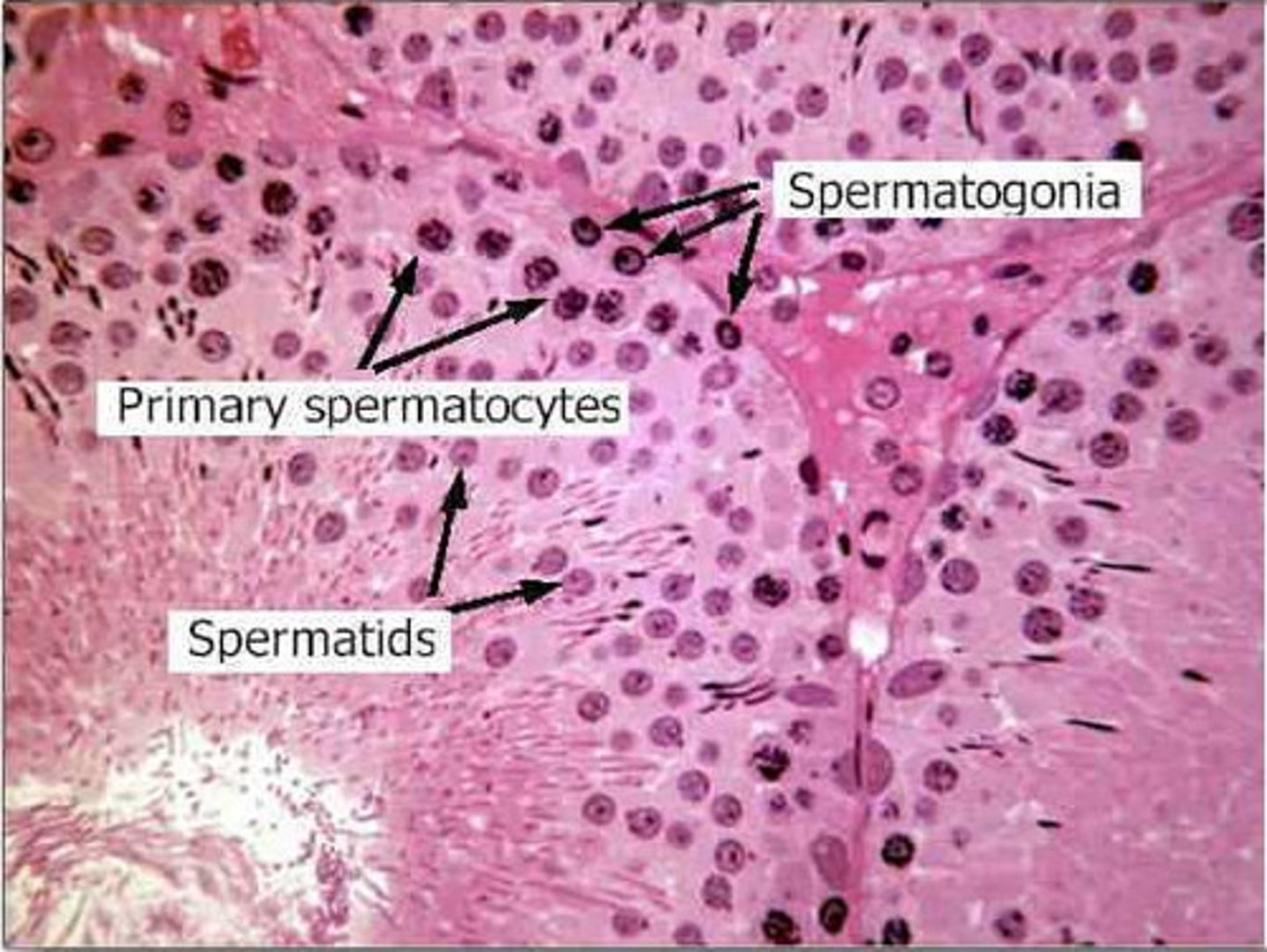<p>the cells comprising the outer rim of the seminiferous tubule. They are the diploid stem cells from which all sperm will arise.</p>